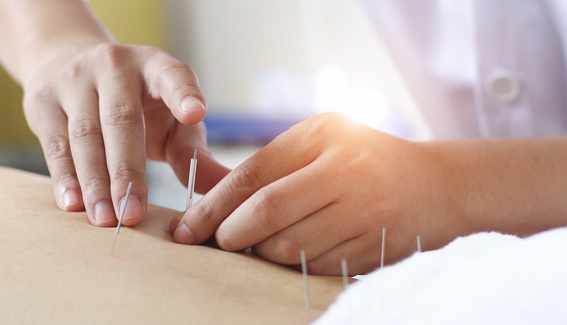 Acupuncture The Benefits Beyond Pain Relief