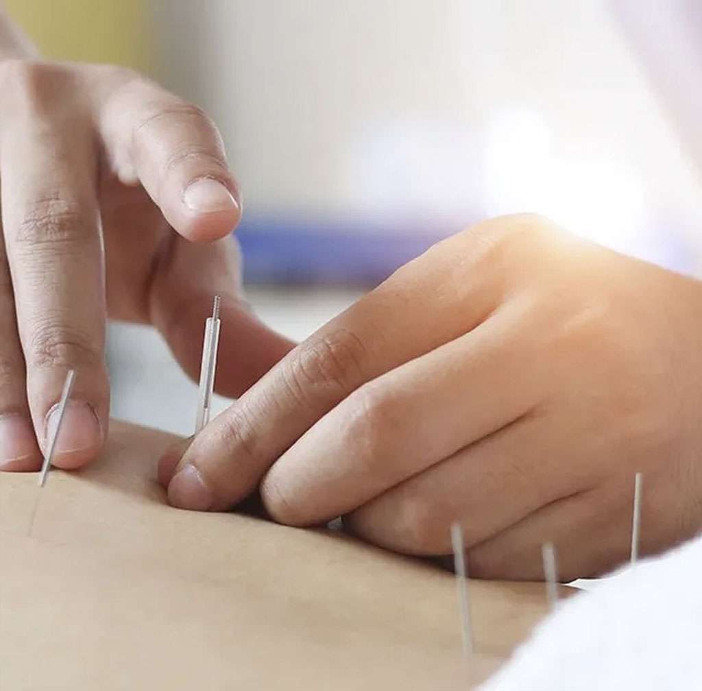 Monmouth Pain & Scoliosis Center - Acupuncture in Wall Township, New Jersey